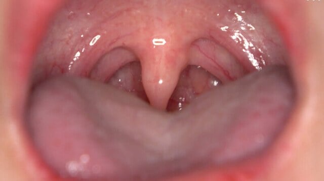 「【歯・口腔フェチ】新人女優相楽さゆなちゃんの口内観察＆巨大女フェチ」わかしラボWAKA-078 相楽さゆな 9
