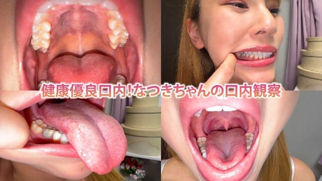 健康優良口内！なつきちゃんの日内観察