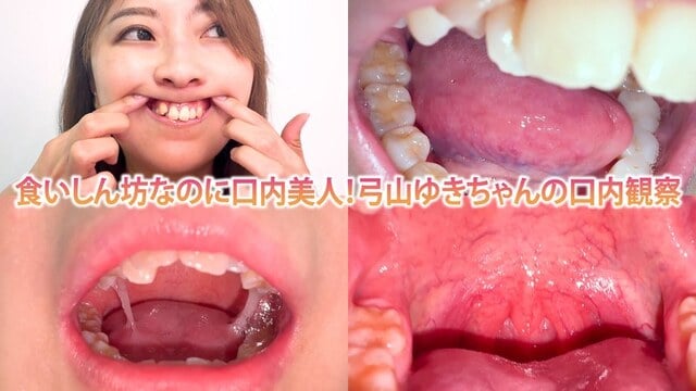 食いしん坊なのに口内美人！弓山ゆきちゃんの口内観察