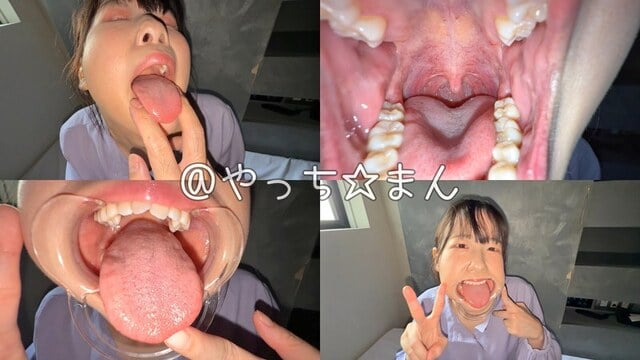 【個人撮影】谷田かりな 開口器で口内観察デカ舌を要チェック